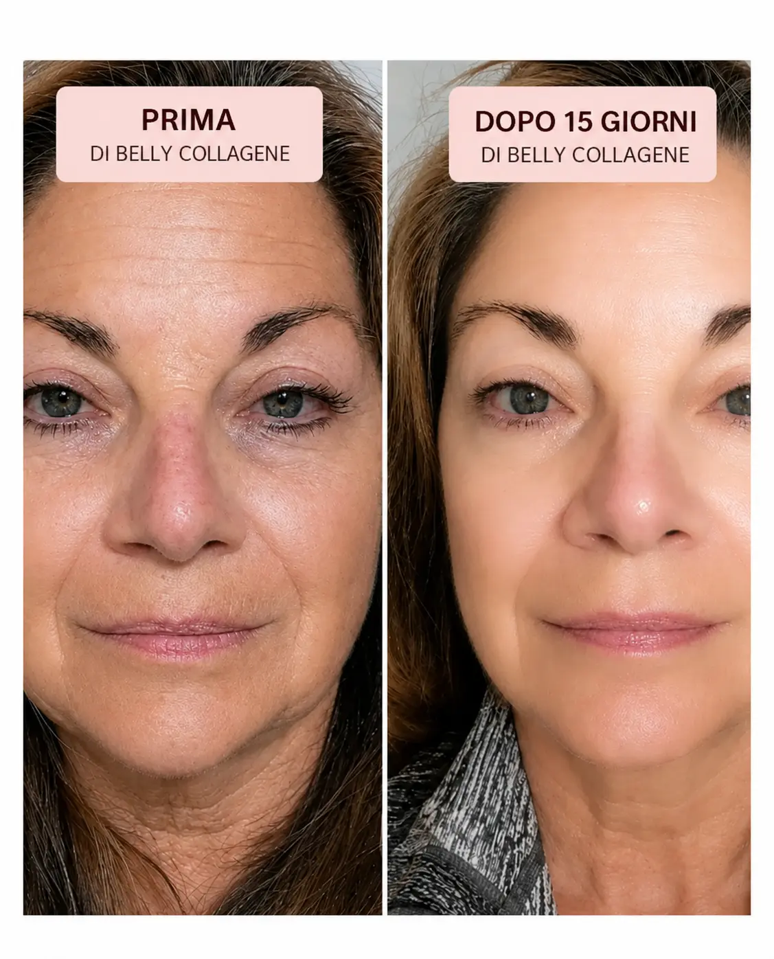 Risultati visibili Belly Collagene prima e dopo